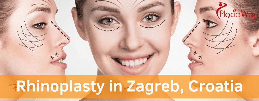 Rhinoplasty in Zagreb, Croatia